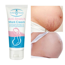 跨境Aichun身体乳清爽不油腻滋润去生长纹批发Stretch mark cream