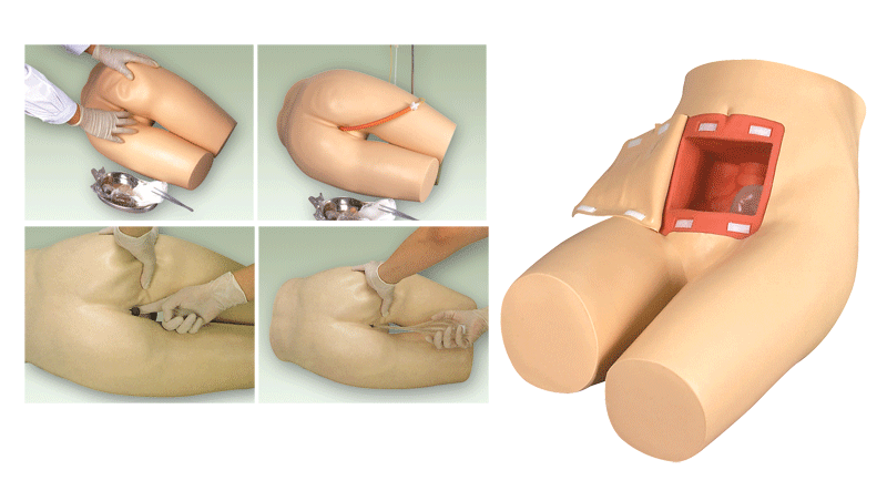 高级灌肠和辅助排便训练模型(护理模型)/灌肠和辅助