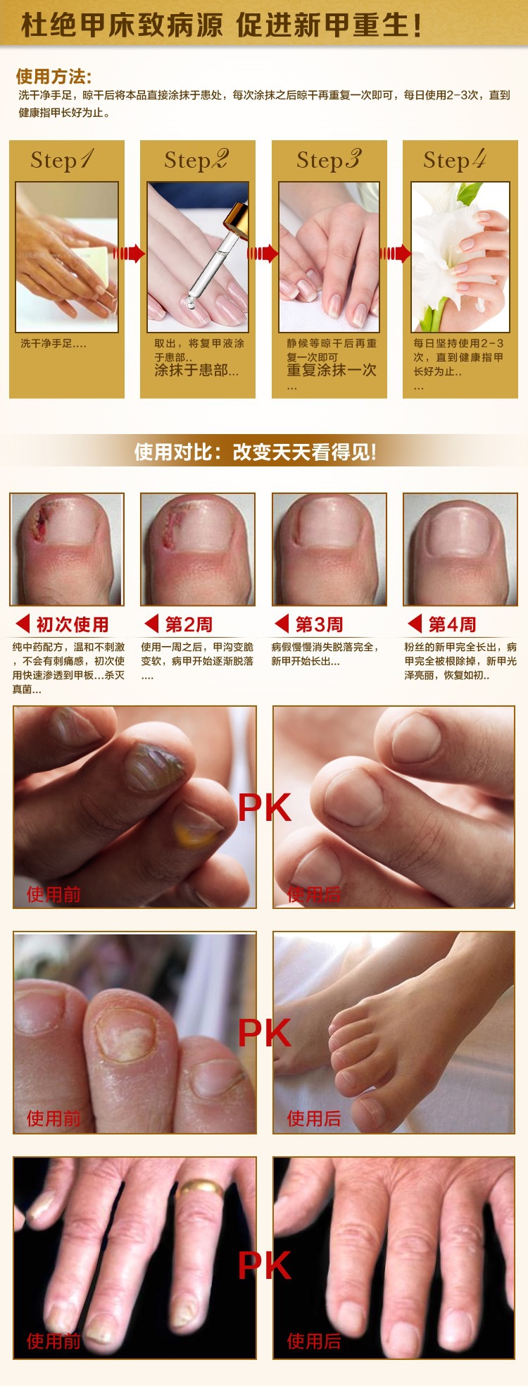 草本活力再生复甲液 中药去除灰指甲黑甲甲癣 亮甲美甲 厂家批发