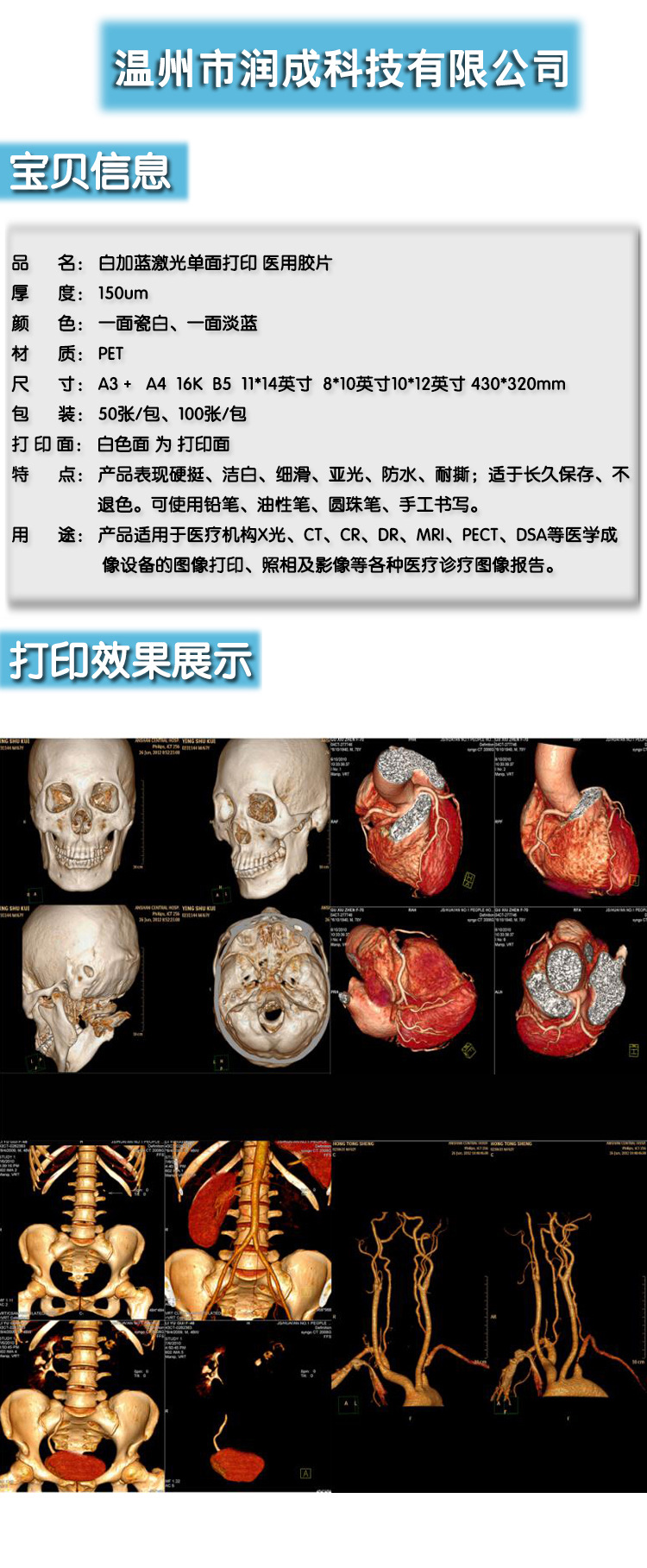 医用胶片白加蓝激光胶片x光胶片ct胶片cr胶片dr胶片
