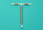 t环(tcu宫内节育器)