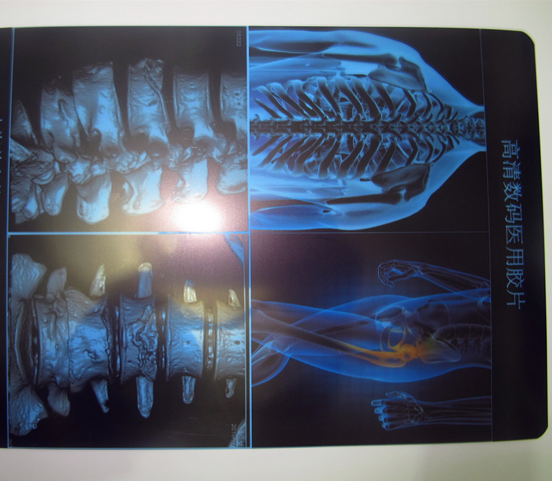 a4 医用蓝片喷墨医疗片新型放射胶片ct,dr,x光胶片新型蓝片