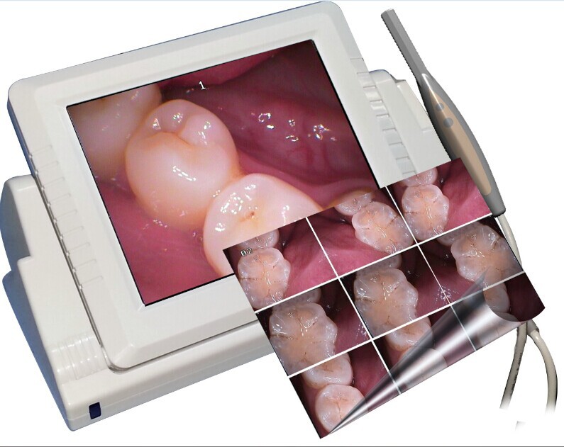 8寸液晶口腔内窥镜一体机 口腔检测仪 口腔放大镜