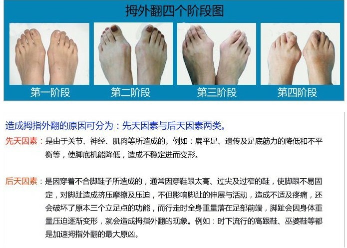 鞋垫脚趾套鞋垫批发分趾器 拇囊炎 一件代发  宝贝详细展示 商品名称