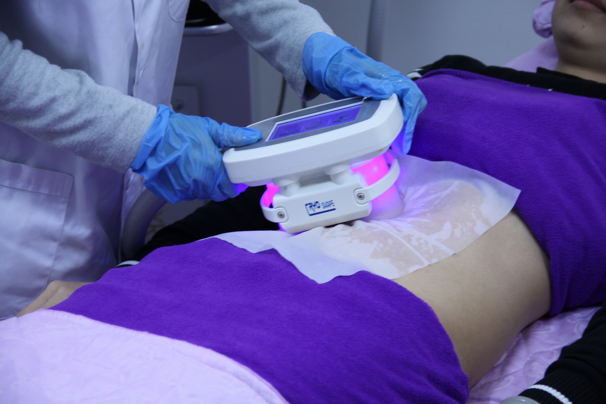 防冻膜 冷冻膜 酷塑冷冻溶脂仪器 防冻片厂家直供