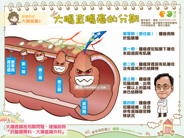 大肠癌侵犯图片