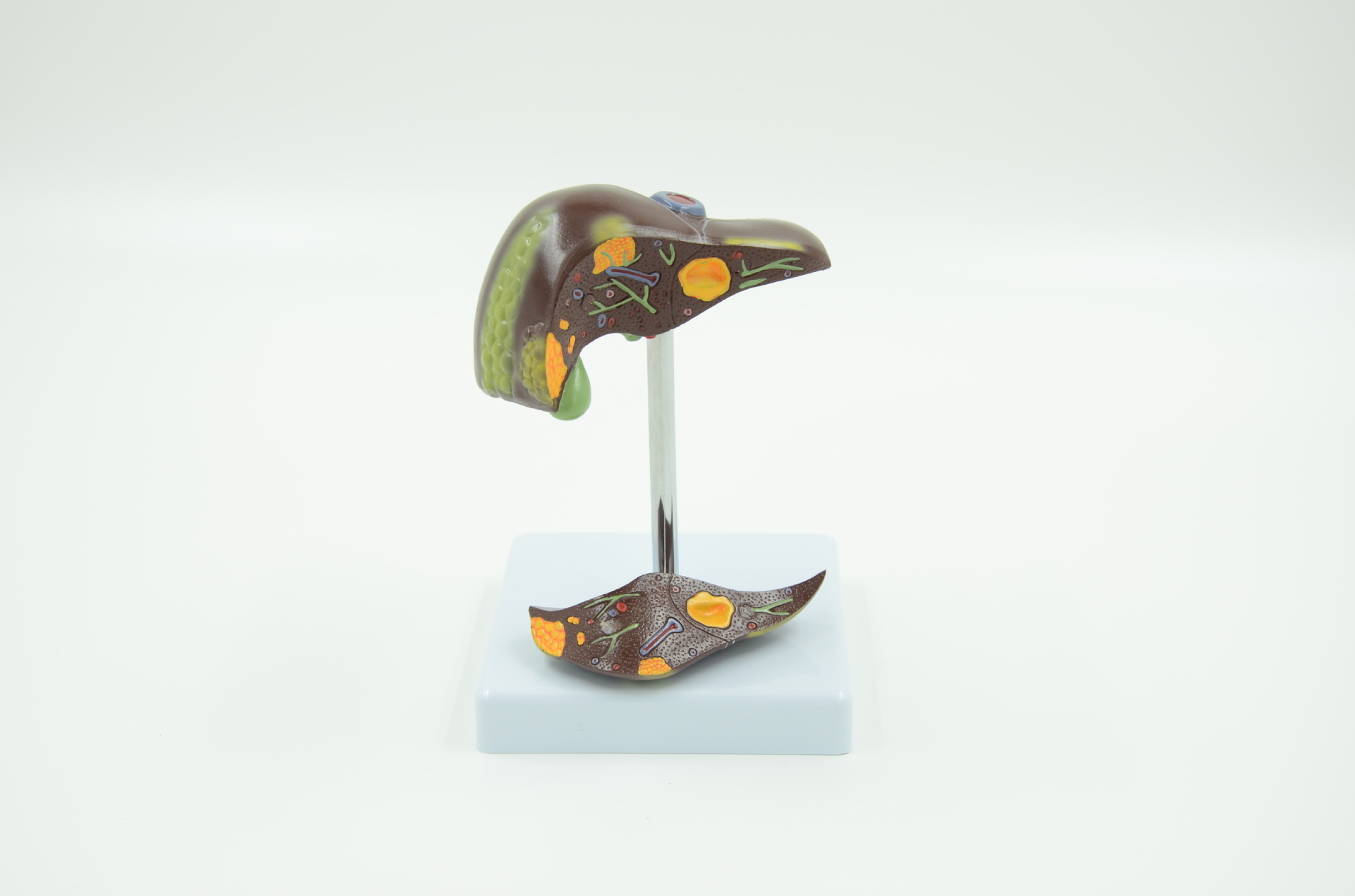 人体肝脏病变解剖模型 医学教学模型 内脏器官 厂家直销