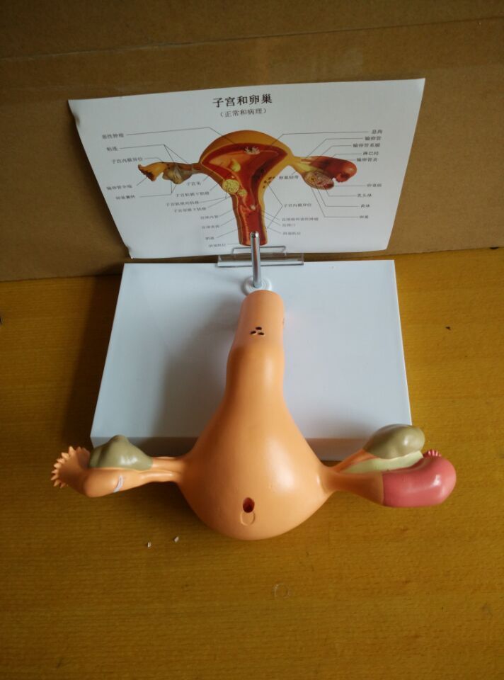病态子宫模型病理模型