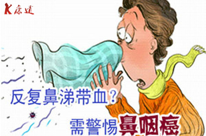 鼻咽癌症状及治疗!