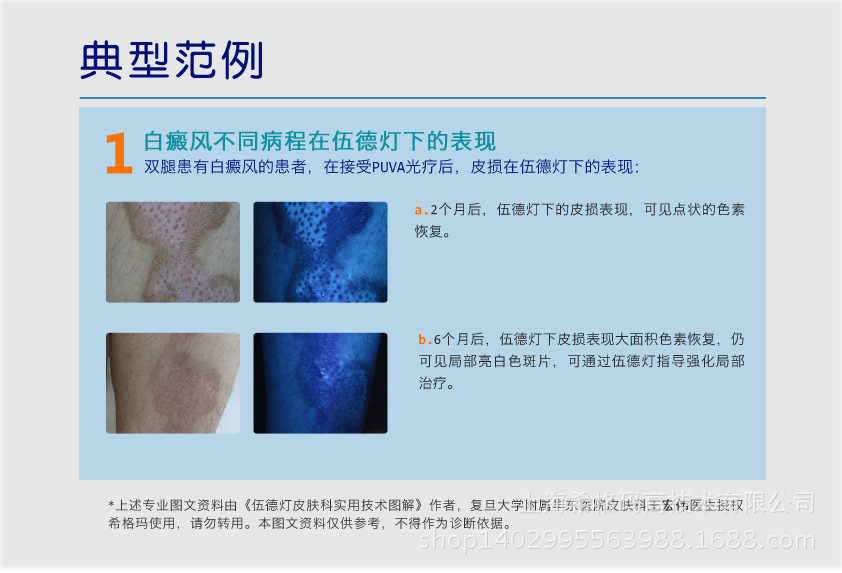 伍德灯wood lamp sw-12