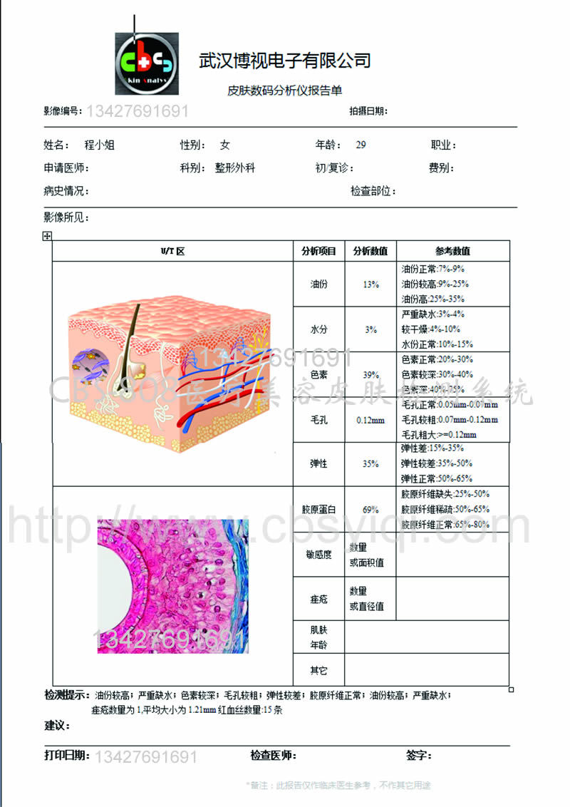 CBS-808数据报告