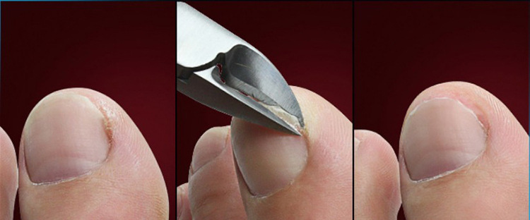 指甲剪套装死皮剪指甲钳不锈钢鹰嘴钳嵌甲钳剪指甲刀灰甲沟钳