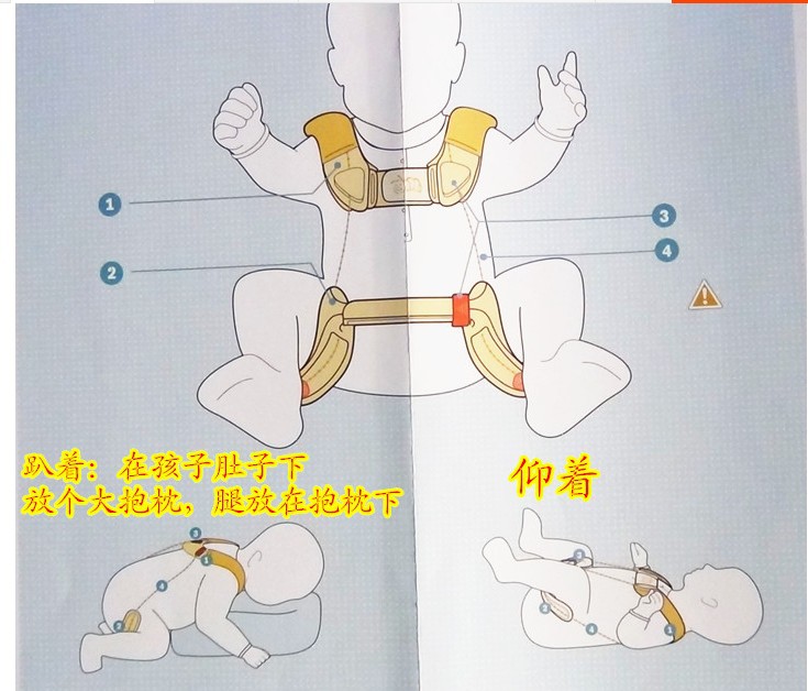 儿童髋关节固定支具髋外展宝宝串珠支架新款儿童髋