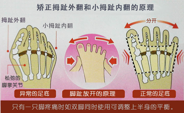 拇指外翻按摩图解图片