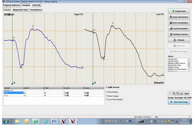 德国电生理_21眼电生理_德国罗兰 RETI-Port\/S