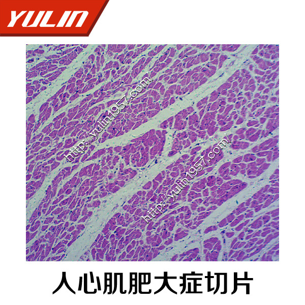人体病理学细胞组织损伤生物玻片标本 生物切片