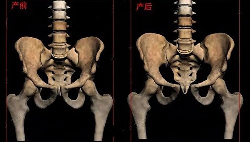 杭州城西产后盆低修复,卵巢保养/盆骨矫正/体型修复