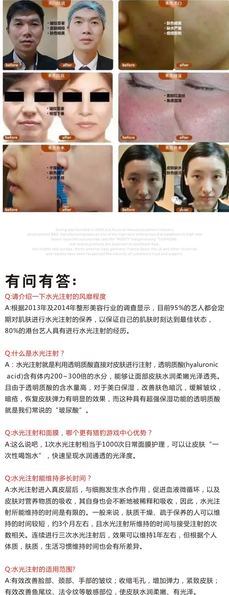 点击打开原图 韩国水光针 韩国优质水光针批发价格