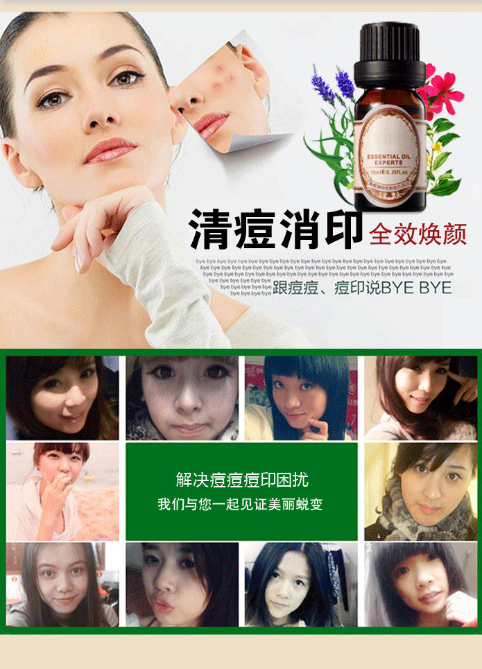 薰衣草精油 祛痘去印控油收细毛孔除痘印去