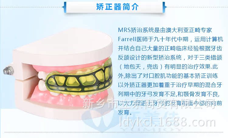 澳大利亚进口i3儿童牙齿矫治器 矫正器牙套 地包天 牙齿不齐 兜牙