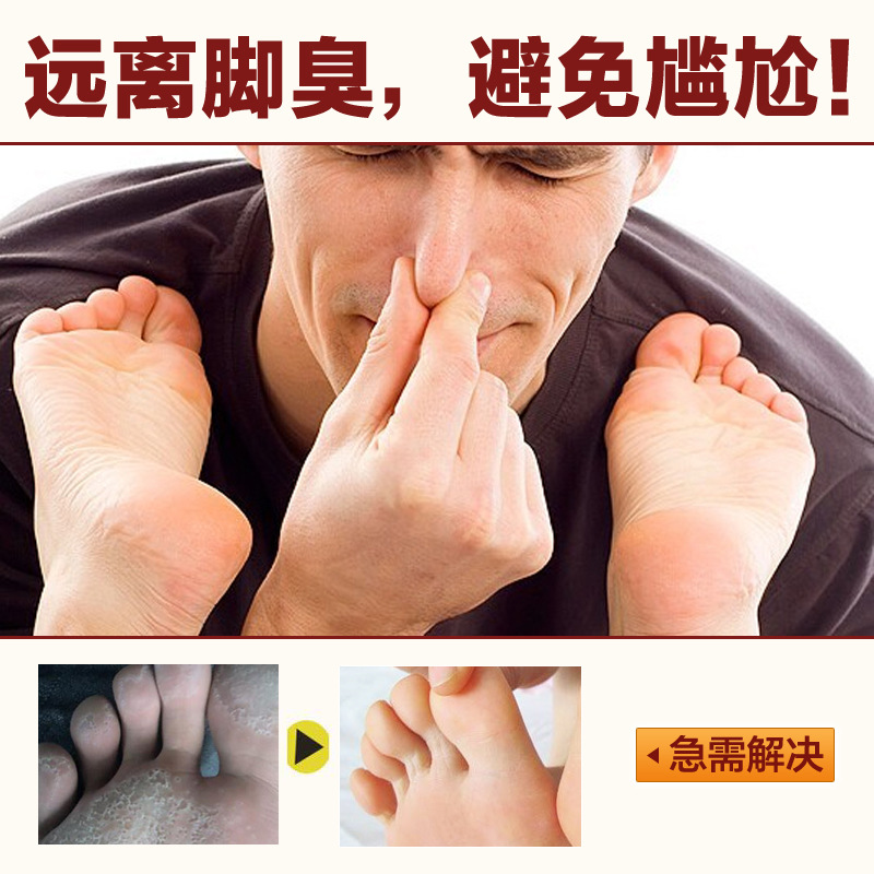 时通足立清脚汽泡脚液oem贴牌正品一件代发去脚臭气脚痒脚汽膏