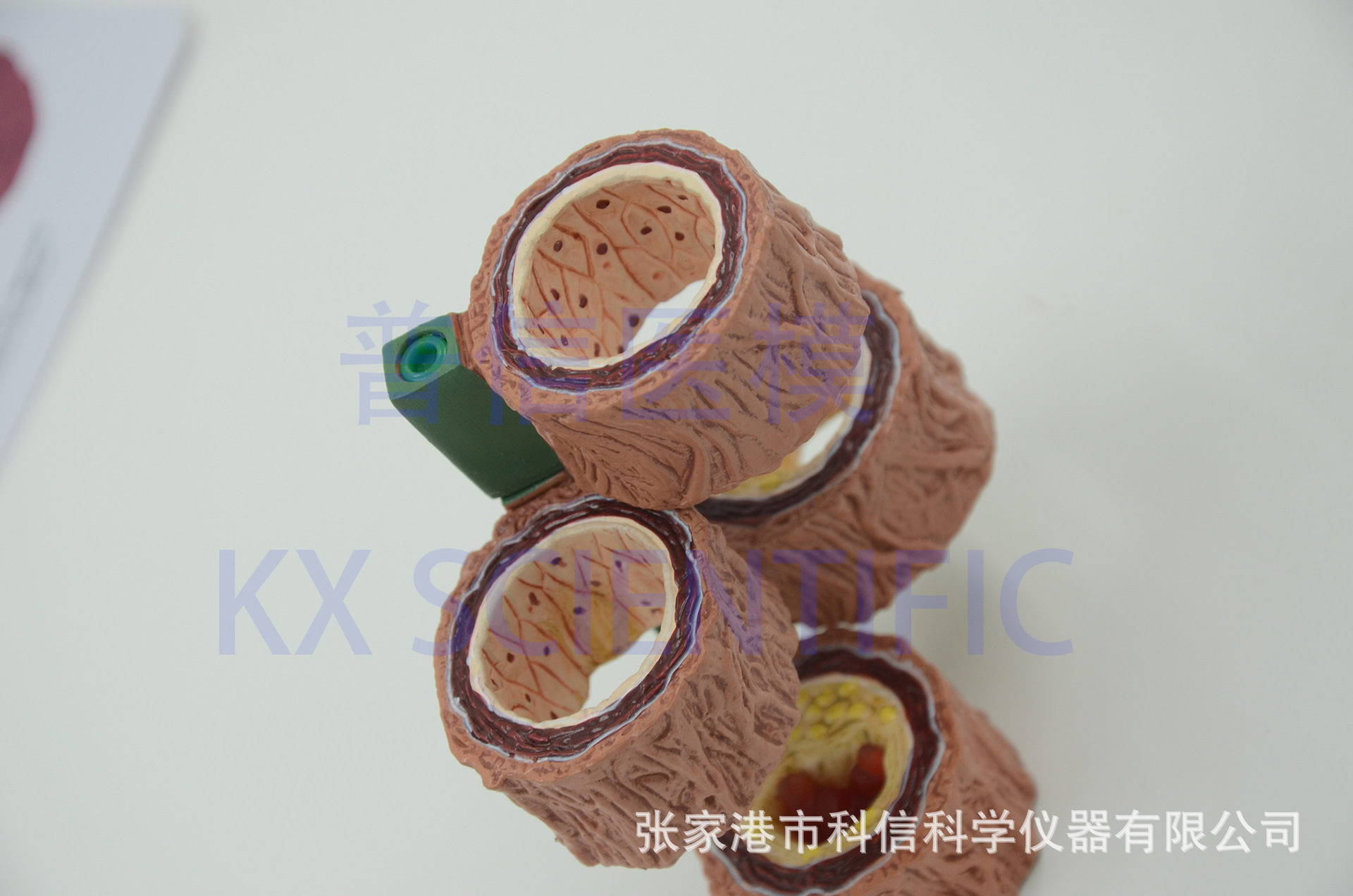 kx-a735 普信 4阶段动脉硬化模型 冠心病心血管粥样化医药礼品