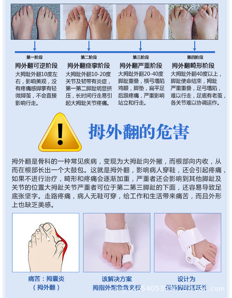 拇外翻矫正器重叠脚趾大脚骨纠正器大脚指矫型分趾器脚趾分离器