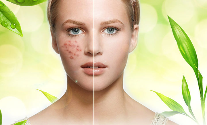 里面有个美女!她的祛痘方法堪称完美!