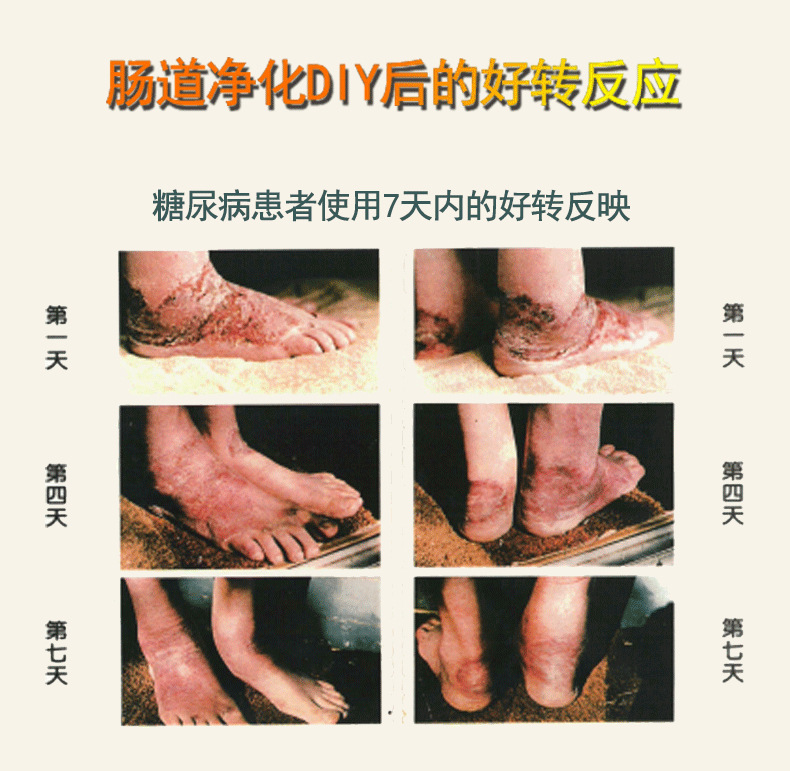 肠道水疗仪器 排宿便 清肠 便秘 润肠通便器 咖啡灌肠器 电动家用