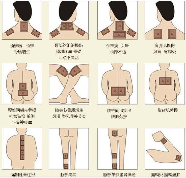 江湖地摊膏药_妙圣打孔弹力布膏药贴 舒适颈肩
