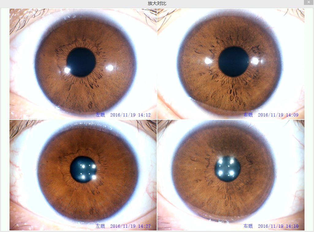 虹膜检测仪_虹膜异色_气象检测仪-圈子花园图片
