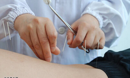 腰椎间盘突出针灸治疗可缓解疼痛 怎样治疗