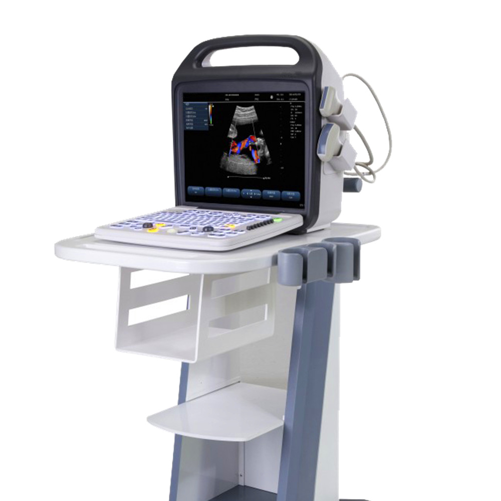 胎儿发育状况b超检查妇科定期体检多普勒超声仪
