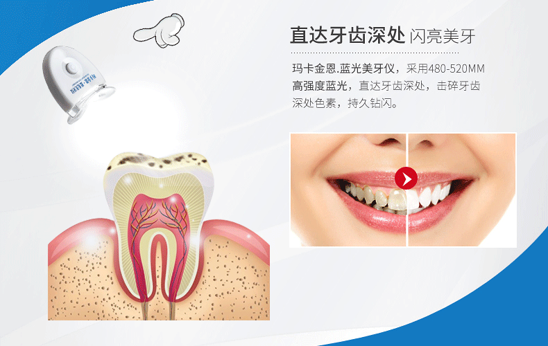 蓝光清洁美牙仪神器速效冷光牙齿美白仪去烟渍大黄牙
