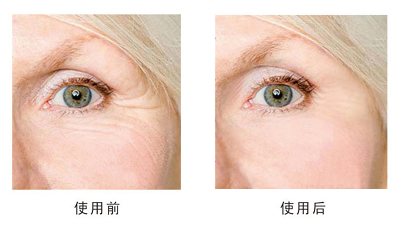 苹果干细胞原液紧致补水祛皱美白精华液厂家直销一件代发