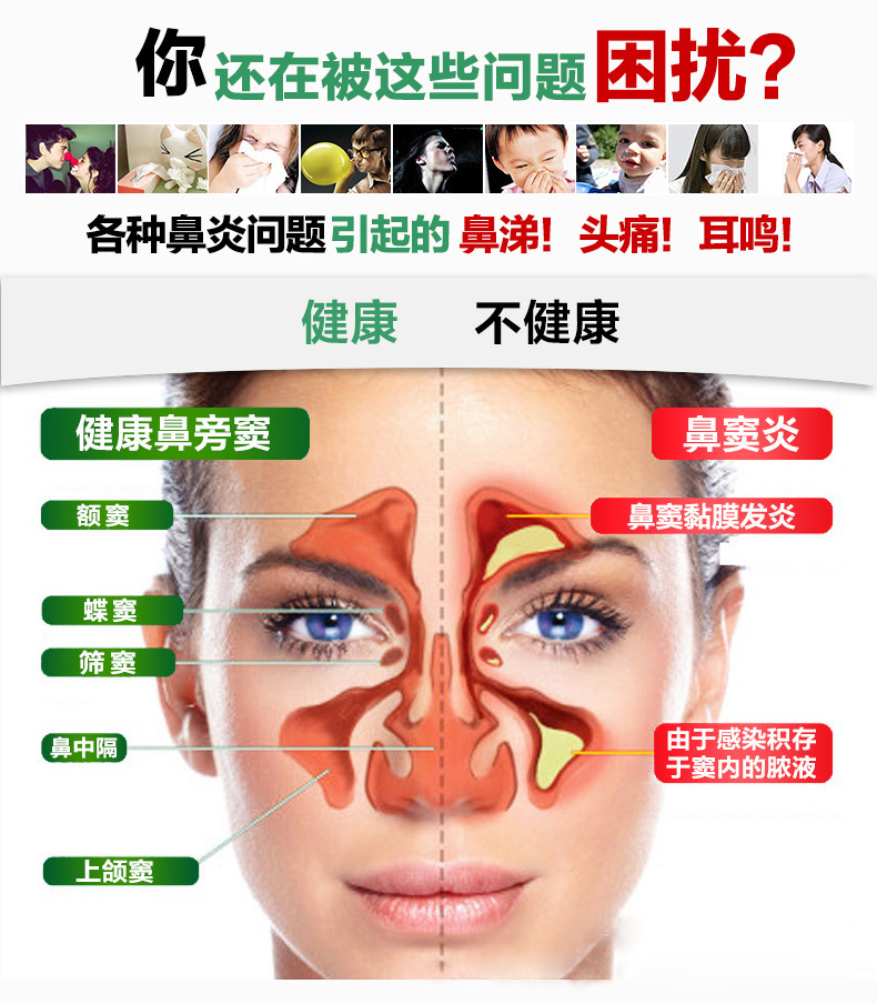 微商爆款鼻炎喷雾oem草本鼻炎精油慢性过