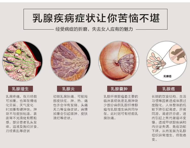 乳腺副乳增生_乳腺增生专题养生讲座_乳腺腺体增生改变
