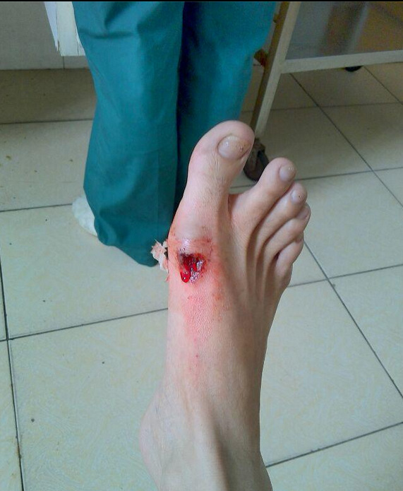 我与高跟鞋不得不说的事# 我与高根鞋最衰的故事