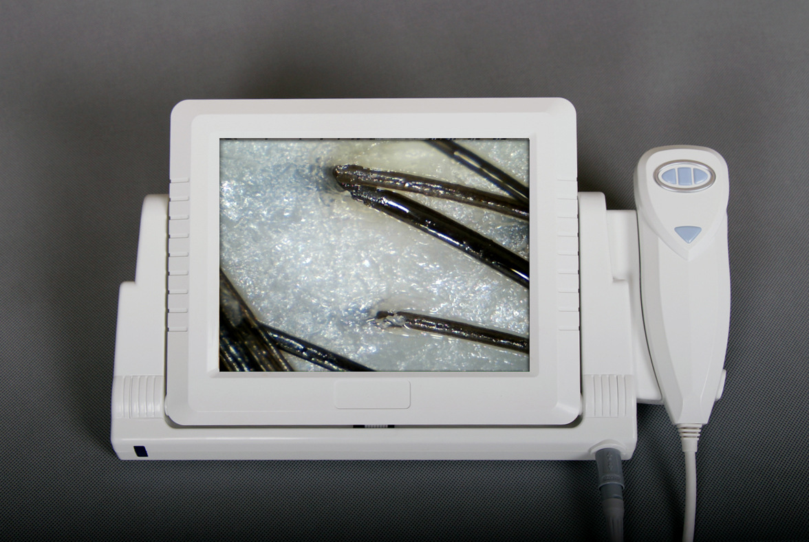 虹膜/皮肤/毛发/头发检测仪/头皮检测仪一体机