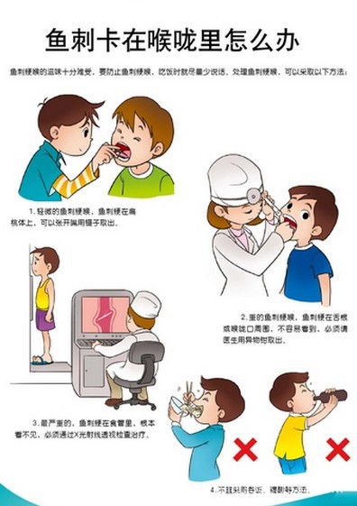 【北商天天见】鱼刺卡了喉咙怎么办呢yc