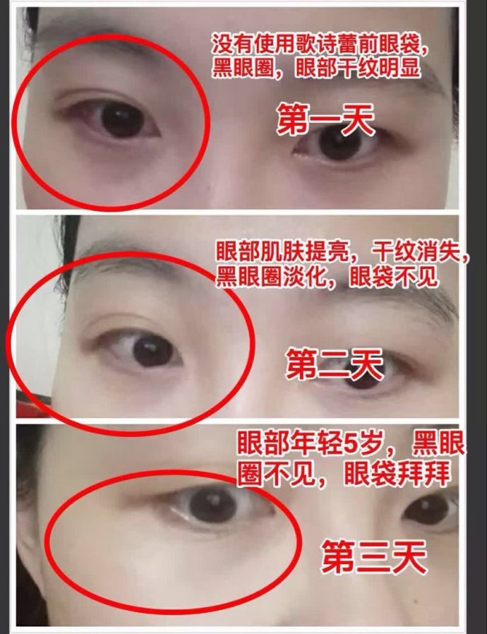 怎么去黑眼圈和眼袋的简单方法?歌诗蕾眼霜好不好?