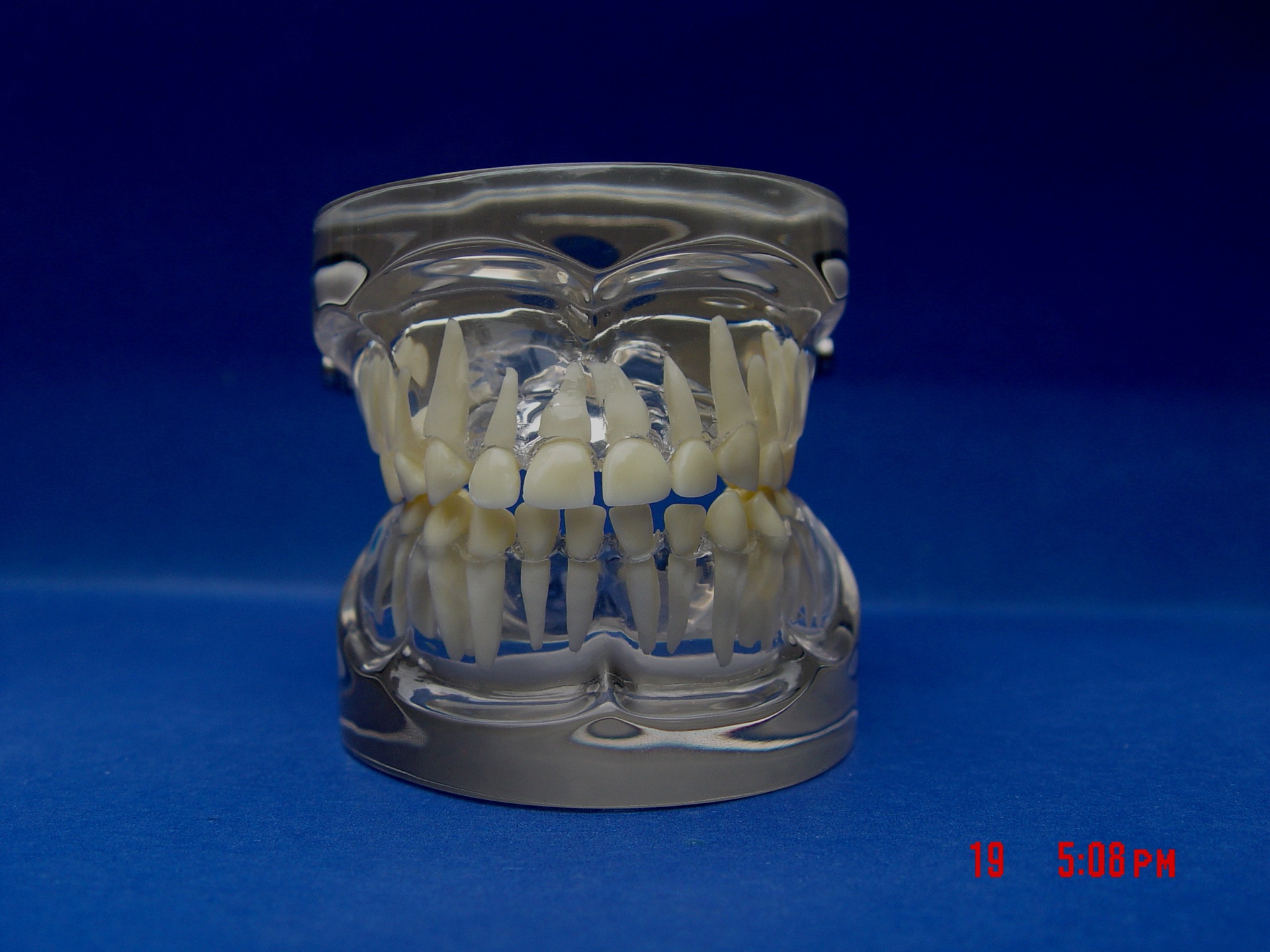 enovo正品 儿童乳牙牙列模型 儿童口腔教学展示模型 牙科牙齿模型