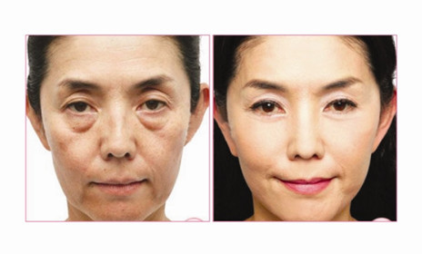 oem/odm化妆品加工 减龄赋活修护精华霜 抗衰修复 祛皱法令川字纹