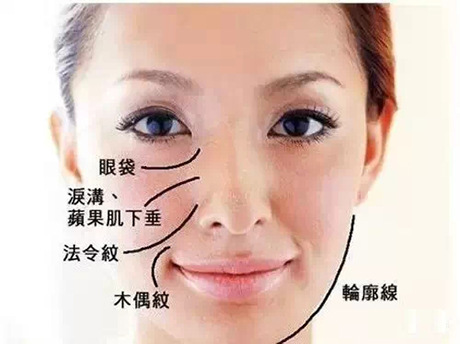 分享成都去眼袋的方法