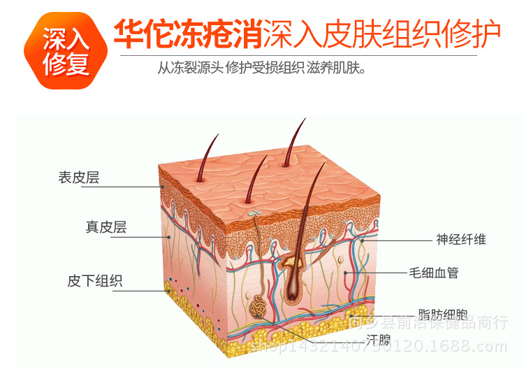 厂家直供佰沐康鹅不食草抑菌膏华佗冻疮消冻疮膏30g
