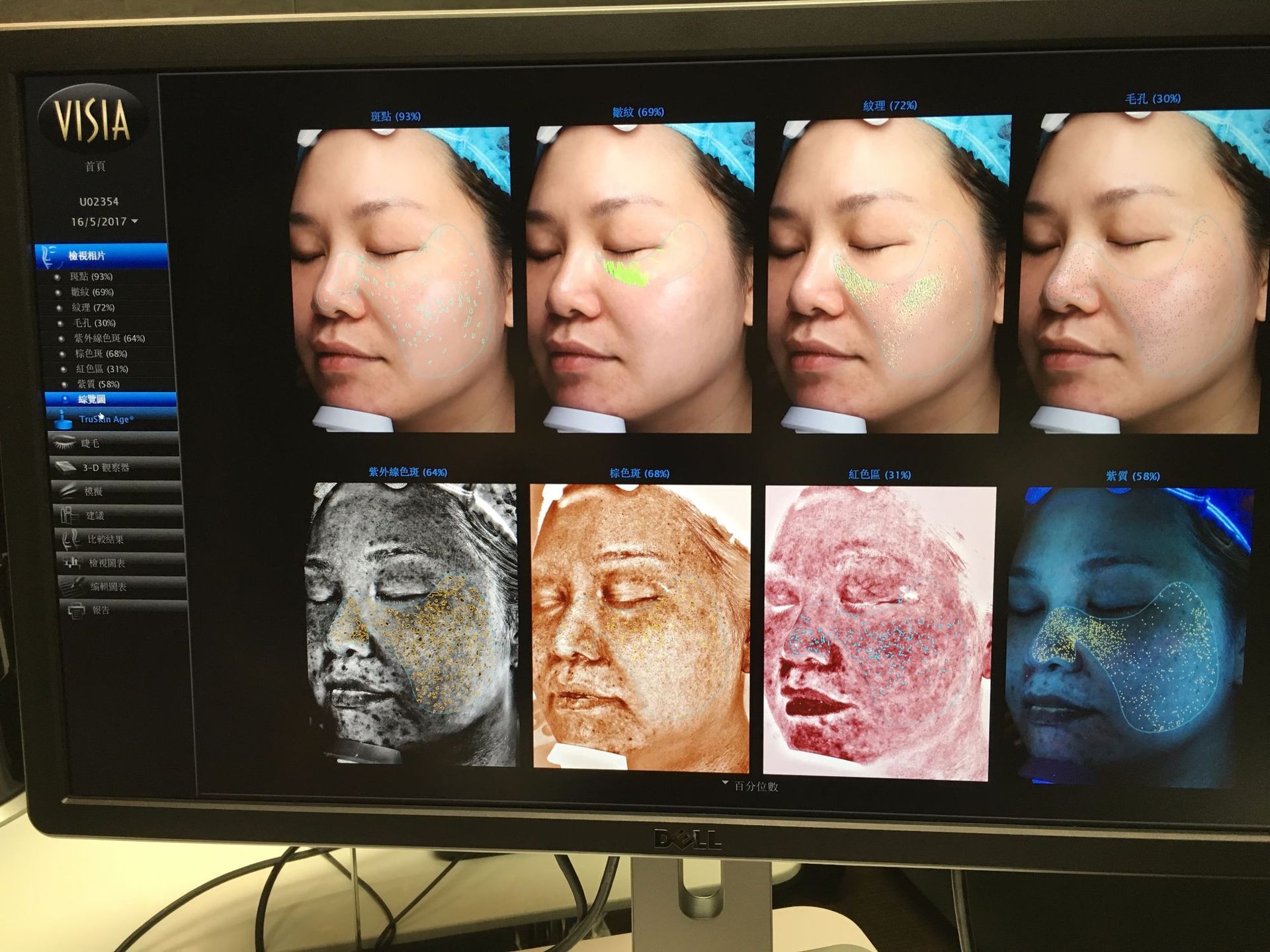 美国visia7代皮肤检测仪面部检测魔镜ct皮肤综合皮肤分析仪