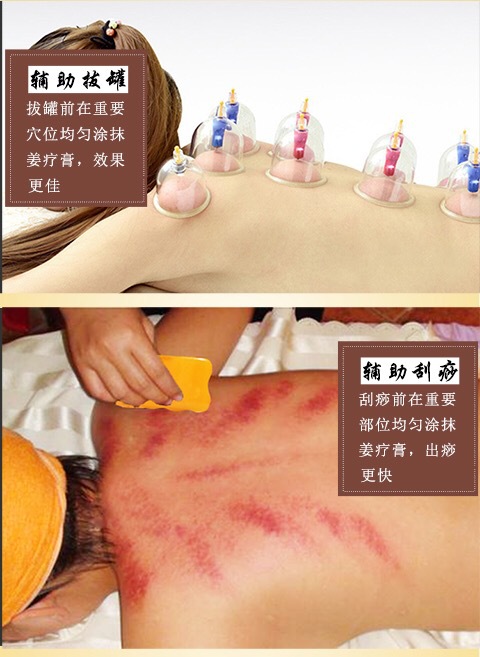 姜疗膏 天然生姜 艾灸 姜疗热能按摩膏 培兰朵 20克