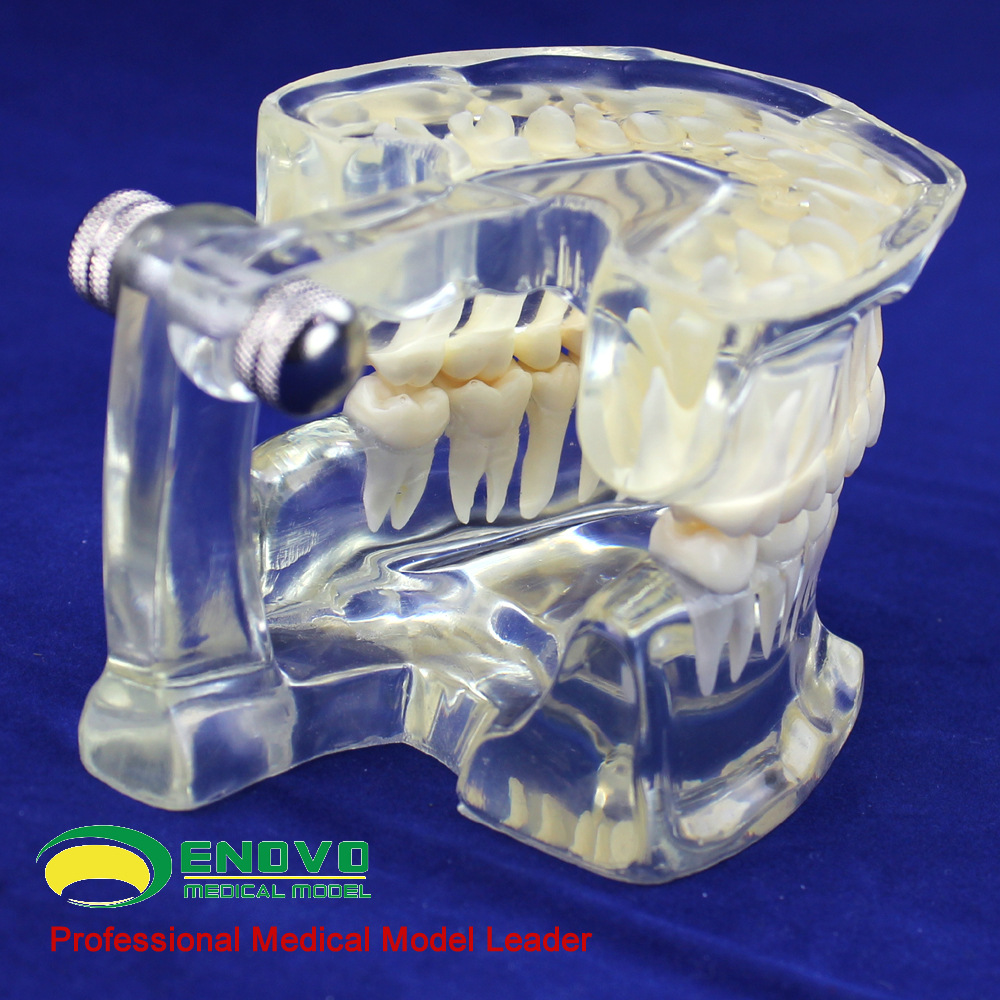 enovo 透明成人标准牙齿模型 口腔牙齿科模型 成人牙列模型