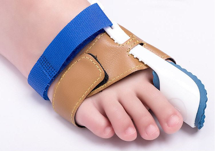 拇外翻矫正器 拇指外翻 夜用大脚骨 大脚趾外翻矫正器批发