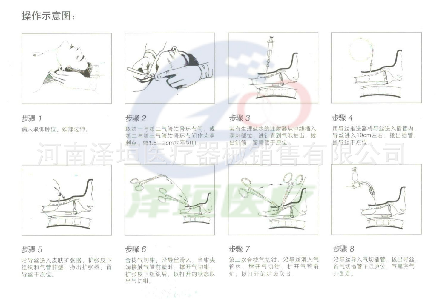 本产品用于气切套管人工呼吸和抽吸呼吸道的分泌物,适用于气管切开